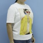 Bariatric Before & After Patient #1389