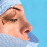 Rhinoplasty Before & After Patient #1446