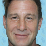 Facelift Before & After Patient #2609