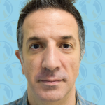 Facelift Before & After Patient #2895