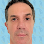 Facelift Before & After Patient #2895