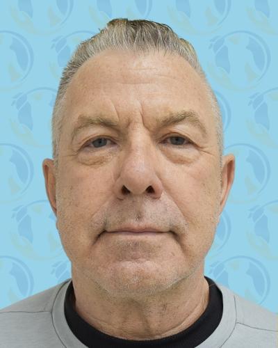 Facelift Before & After Patient #2896