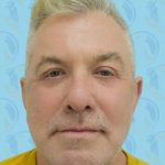 Facelift Before & After Patient #2896