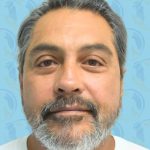 Facelift Before & After Patient #2897