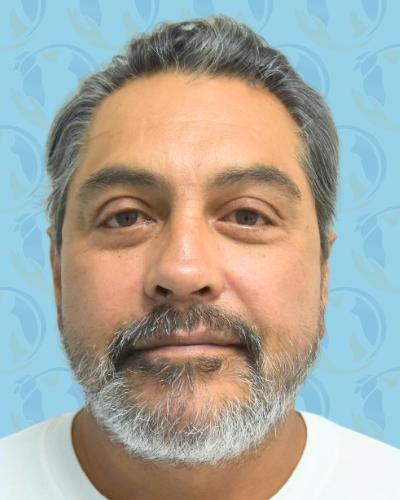 Facelift Before & After Patient #2897