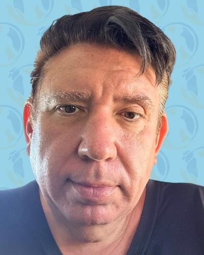 Facelift Before & After Patient #2900