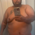 Bariatric Before & After Patient #2937