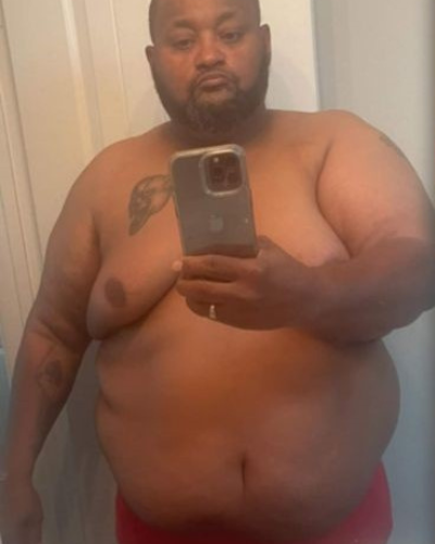 Bariatric Before & After Patient #2937