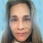 Facelift Before & After Patient #2949