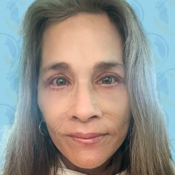 Facelift Before & After Patient #2949
