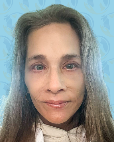 Facelift Before & After Patient #2949