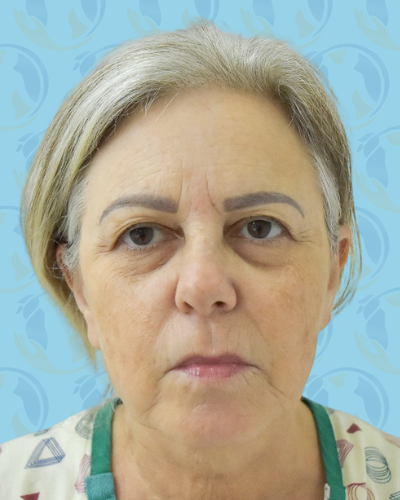Facelift Before & After Patient #2952