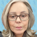Facelift Before & After Patient #2952